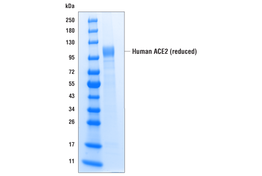 undefined Image 1: Human ACE2 (multimeric) (18-652) Recombinant Protein