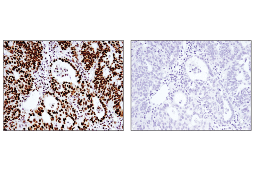 undefined Image 36: BAF Complex IHC Antibody Sampler Kit