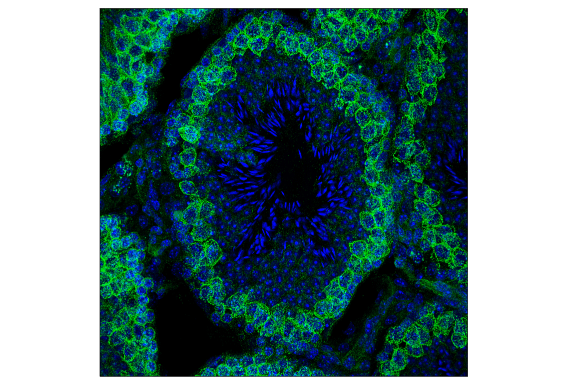 Immunofluorescence Image 1: Numb (C29G11) Rabbit mAb
