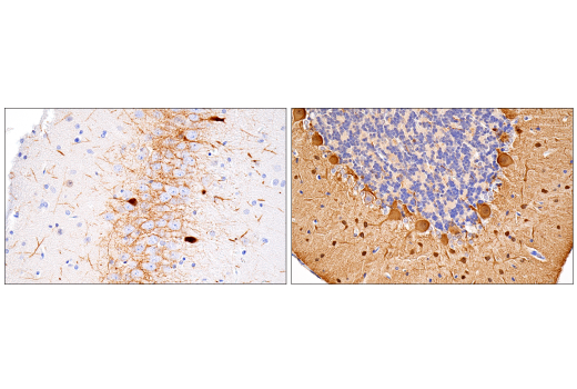 Immunohistochemistry Image 8: Parvalbumin (E8N2U) XP<sup>®</sup> Rabbit mAb