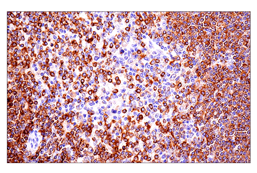 Immunohistochemistry Image 5: CD22 (E7L6Z) XP<sup>®</sup> Rabbit mAb (BSA and Azide Free)