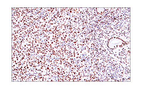 Immunohistochemistry Image 4: 53BP1 (E7N5D) XP<sup>®</sup> Rabbit mAb (BSA and Azide Free)
