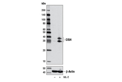 Western Blotting Image 1: CISH (D4C10) Rabbit mAb