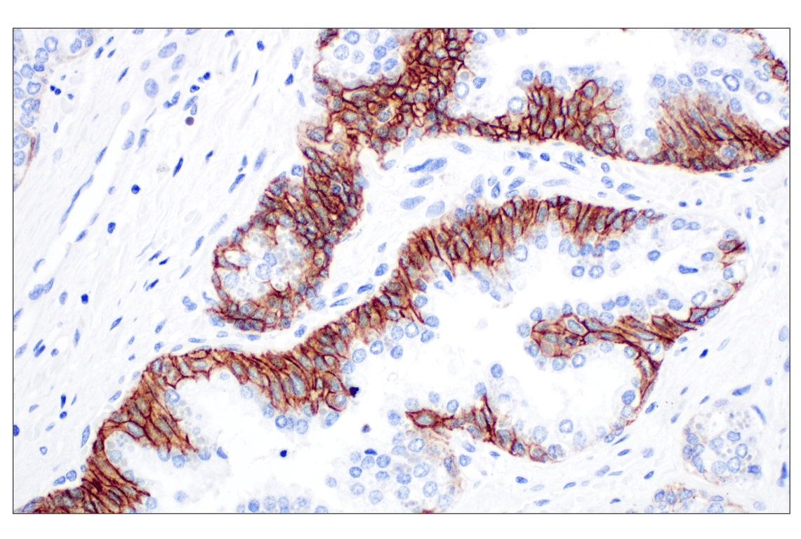 Immunohistochemistry Image 1: CD44 v5 (C44Mab-3) Mouse mAb
