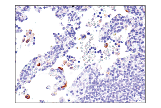 Immunohistochemistry Image 2: Axl (C89E7) Rabbit mAb (BSA and Azide Free)