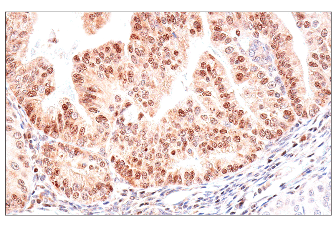 Immunohistochemistry Image 1: ADAR1 p150 Isoform   (E6U1U) Rabbit mAb   (BSA and Azide Free)