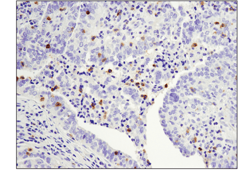 Immunohistochemistry Image 1: PD-1 (Intracellular Domain) (D4W2J) XP<sup>®</sup> Rabbit mAb
