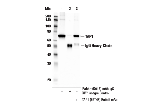 undefined Image 31: MHC Class I Antigen Processing and Presentation Antibody Sampler Kit