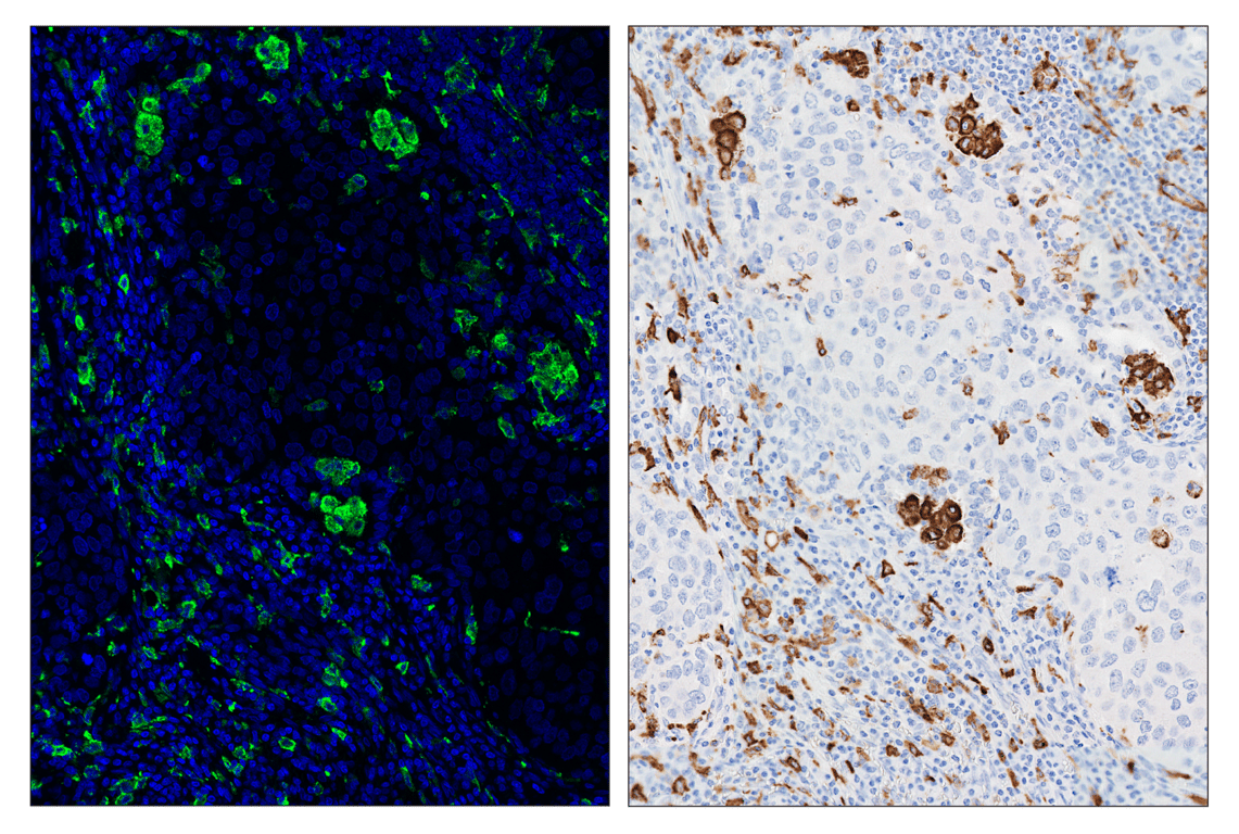 Immunohistochemistry Image 6: CD206/MRC1 (E2L9N) & CO-0035-594 SignalStar<sup>™</sup> Oligo-Antibody Pair