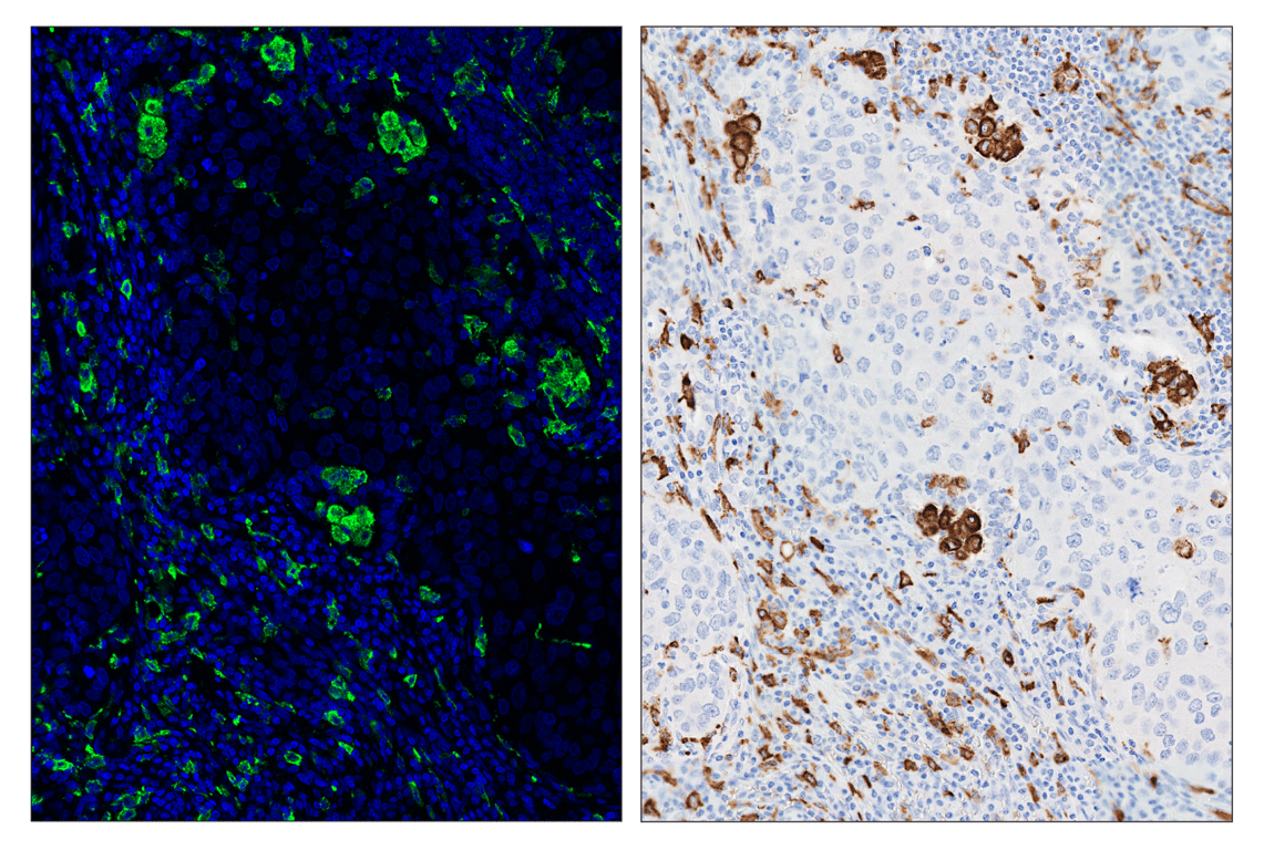 Immunohistochemistry Image 6: CD206/MRC1 (E2L9N) & CO-0035-488 SignalStar<sup>™</sup> Oligo-Antibody Pair