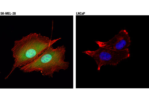 undefined Image 48: Microglia Neurodegeneration Module Antibody Sampler Kit