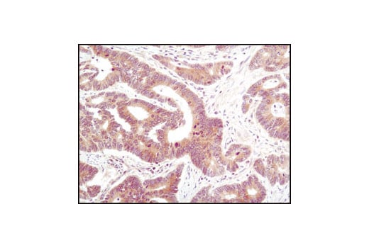 Immunohistochemistry Image 2: PP2C-α (D18C10) XP<sup>®</sup> Rabbit mAb (BSA and Azide Free)