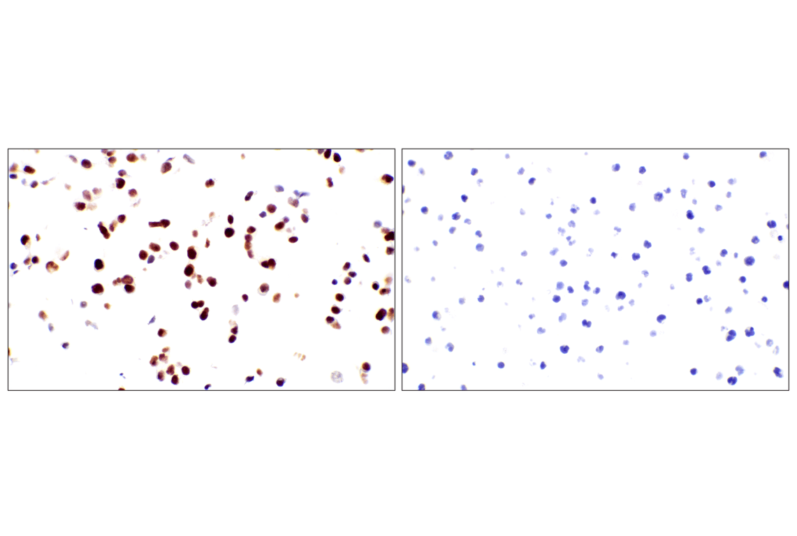 Immunohistochemistry Image 24: GATA-6 (D61E4) XP<sup>®</sup> Rabbit mAb (BSA and Azide Free)