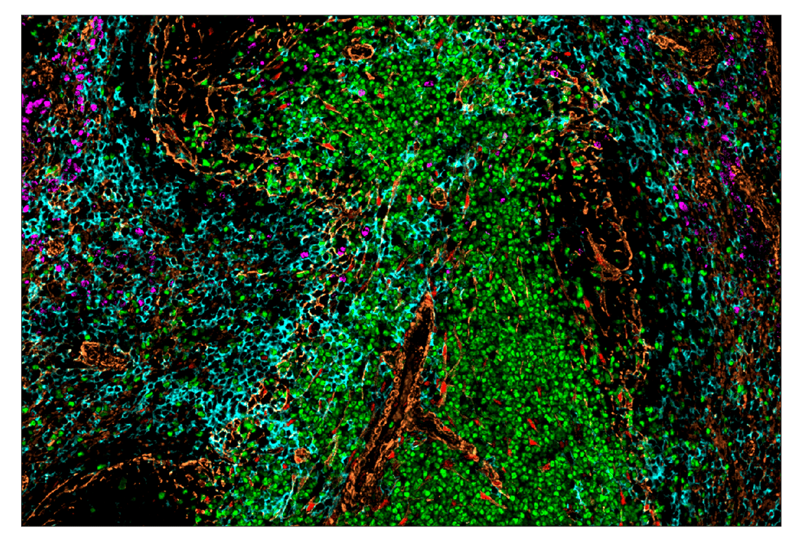 Immunohistochemistry Image 7: Ki-67 (D3B5) & CO-0052-488 SignalStar<sup>™</sup> Oligo-Antibody Pair