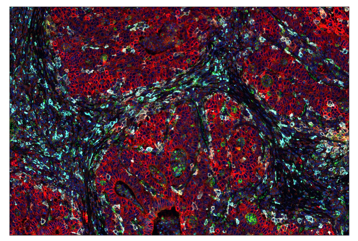 Immunohistochemistry Image 1: CD163 (D6U1J) & CO-0022-488 SignalStar<sup>™</sup> Oligo-Antibody Pair