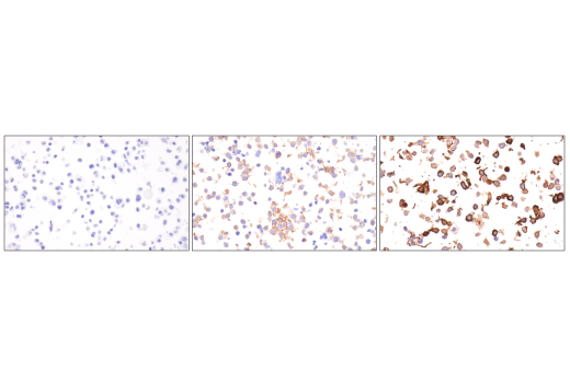 Immunohistochemistry Image 5: Integrin α1/CD49a (E9K2J) XP<sup>®</sup> Rabbit mAb (BSA and Azide Free)