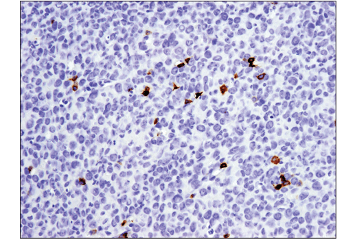 Immunohistochemistry Image 1: PD-1 (Intracellular Domain) (D7D5W) XP<sup>®</sup> Rabbit mAb