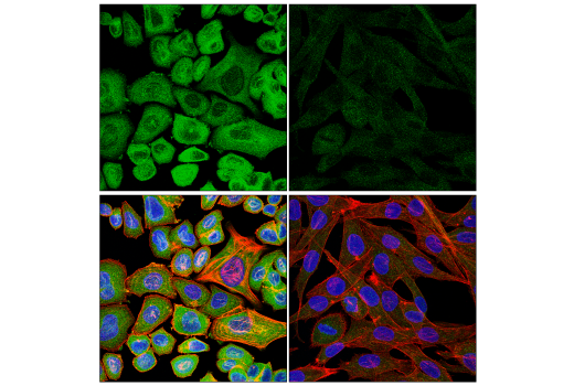 Immunofluorescence Image 1: CaMKII-γ (E4C3O) Rabbit mAb