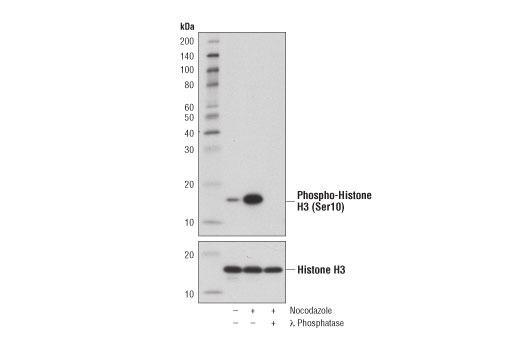 Western Blotting Image 1: Phospho-Histone H3 (Ser10) (D7N8E) XP<sup>®</sup> Rabbit mAb (BSA and Azide Free)