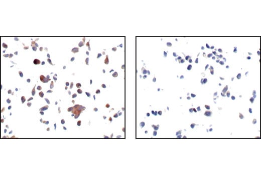 Immunohistochemistry Image 2: Phospho-GSK-3α (Ser21) (36E9) Rabbit mAb