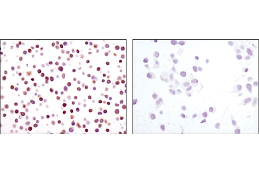 Immunohistochemistry Image 4: NFAT1 (D43B1) XP<sup>®</sup> Rabbit mAb