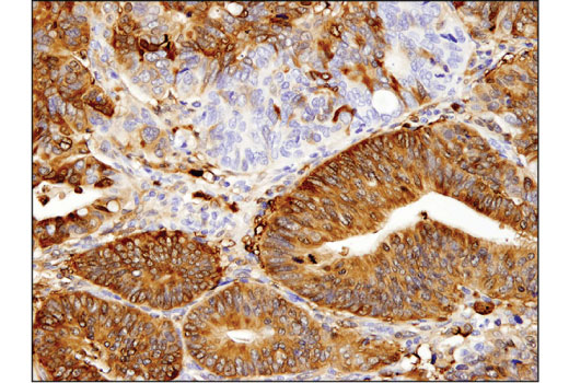 Immunohistochemistry Image 1: ALDH1A1 (D9Q8E) XP<sup>®</sup> Rabbit mAb (BSA and Azide Free)