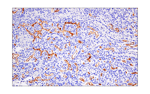 Immunohistochemistry Image 1: CD200 (E5I9V) XP<sup>®</sup> Rabbit mAb