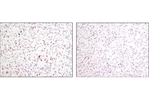 undefined Image 4: PhosphoPlus<sup>®</sup> c-Jun (Ser73) Antibody Duet