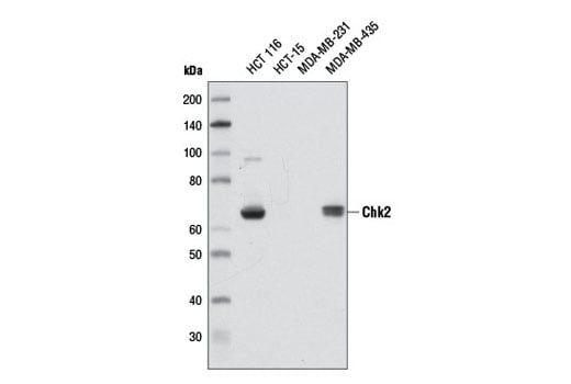 undefined Image 9: PhosphoPlus<sup>®</sup> Chk2 (Thr68) Antibody Duet