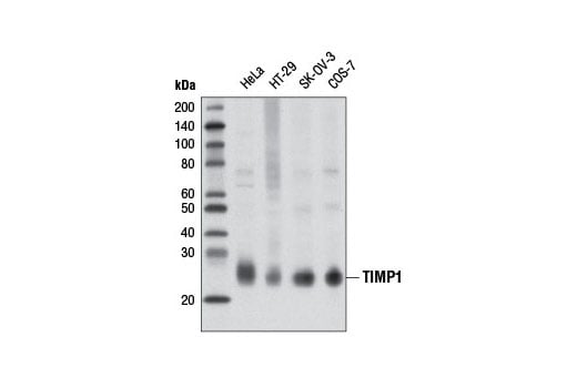 Western Blotting Image 1: TIMP1 (D10E6) Rabbit mAb (BSA and Azide Free)