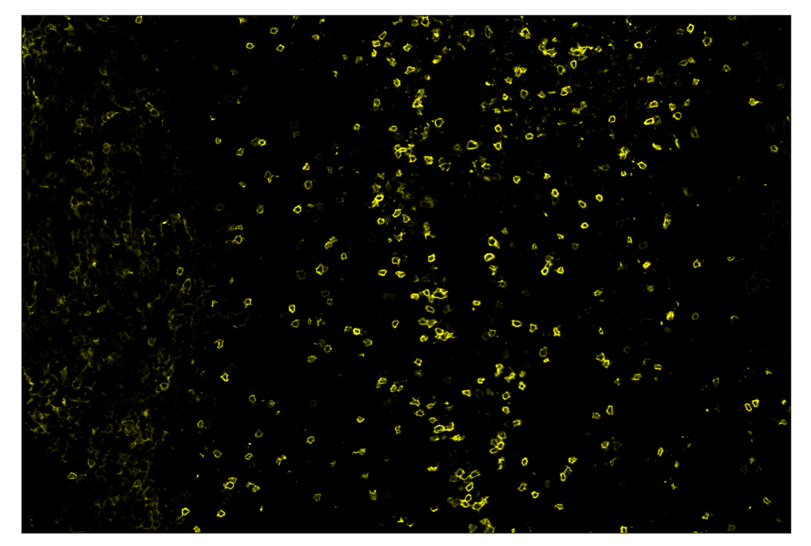 Immunohistochemistry Image 3: IL-2Rα/CD25 (E9W2J) & CO-0074-647 SignalStar<sup>™</sup> Oligo-Antibody Pair