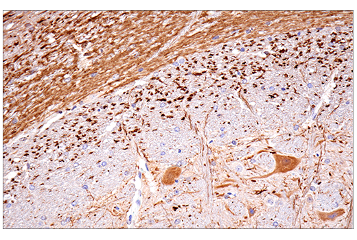 Immunohistochemistry Image 11: Calretinin (E7R6O) XP<sup>®</sup> Rabbit mAb