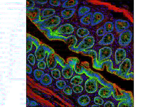 undefined Image 4: PhosphoPlus<sup>®</sup> β-Catenin (Ser675) Antibody Duet