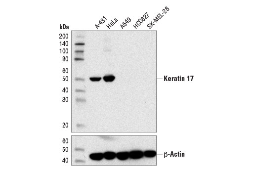 Western Blotting Image 1: Keratin 17 (D12E5) XP<sup>®</sup> Rabbit mAb