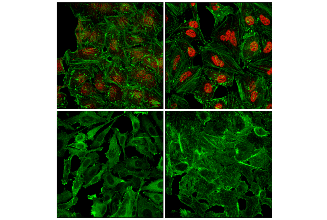 Immunofluorescence Image 1: Stat3 (124H6) Mouse mAb