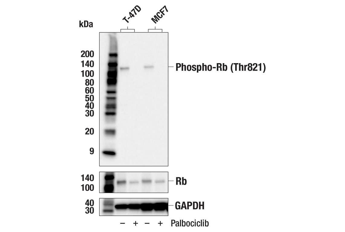 Western Blotting Image 1: Phospho-Rb (Thr821) (E6J1L) Rabbit mAb (BSA and Azide Free)