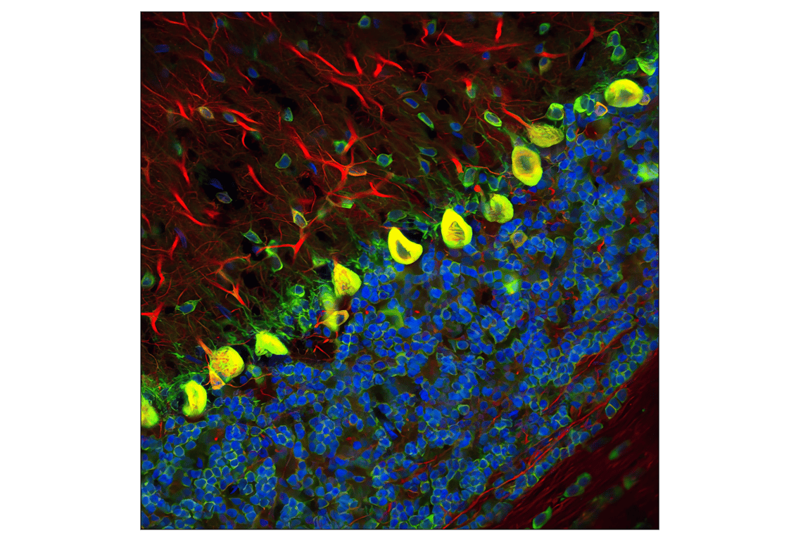 Immunofluorescence Image 1: S6 Ribosomal Protein (54D2) Mouse mAb (Alexa Fluor® 488 Conjugate)