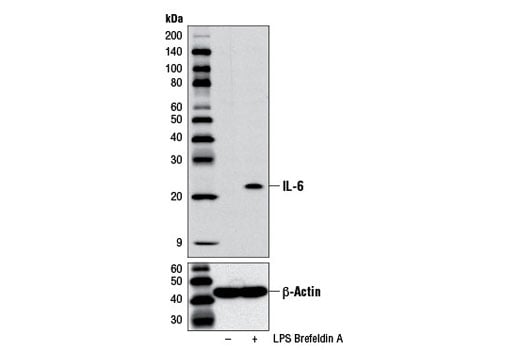 Western Blotting Image 1: IL-6 (D5W4V) XP<sup>®</sup> Rabbit mAb