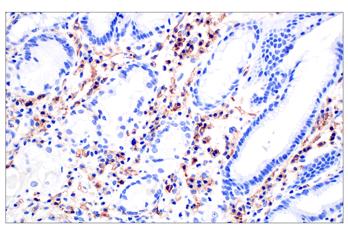 Immunohistochemistry Image 11: CD31 (PECAM-1) (F8M3S) Rabbit mAb (BSA and Azide Free)
