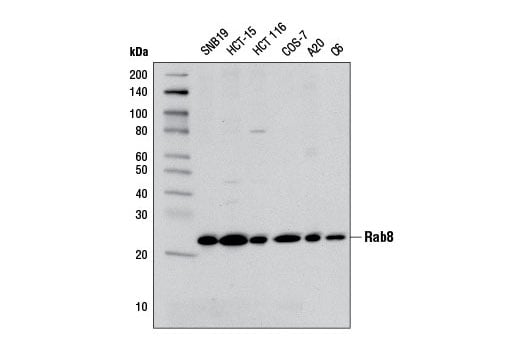 Western Blotting Image 1: Rab8A (D22D8) XP<sup>®</sup> Rabbit mAb