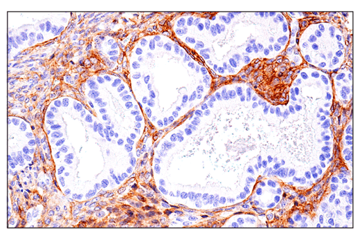 Immunohistochemistry Image 4: CD248 (E9Z7O) XP<sup>®</sup> Rabbit mAb