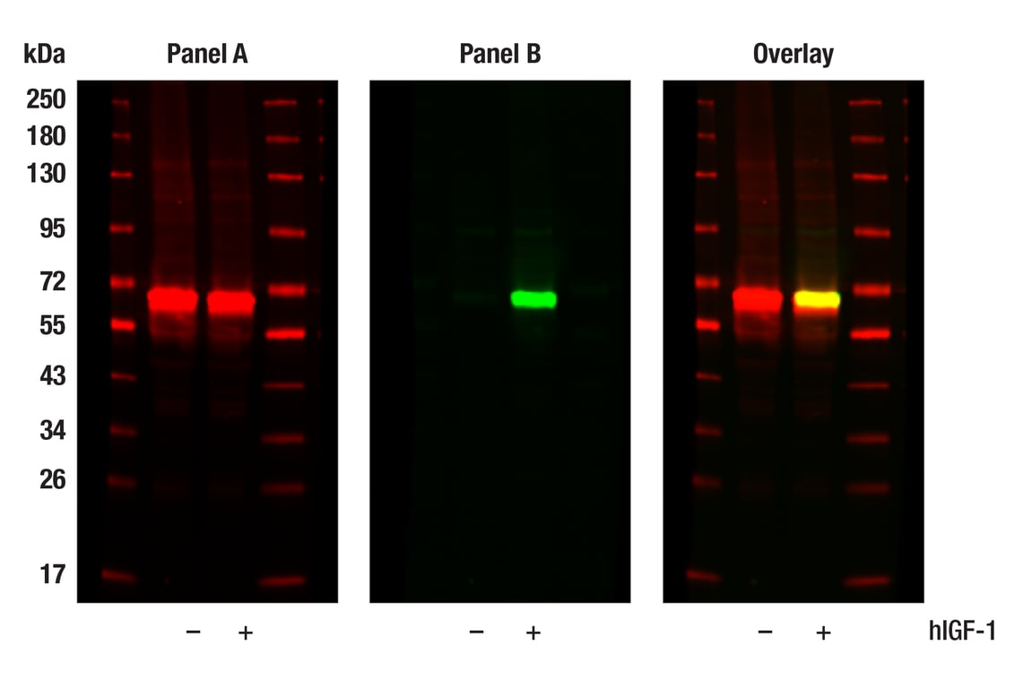 Western Blotting Image 1: Phospho-Akt (Ser473) (193H12) Rabbit mAb