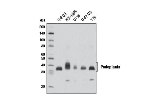 Western Blotting Image 1: Podoplanin (D9D7) Rabbit mAb (BSA and Azide Free)