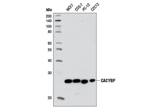 Western Blotting Image 1: CACYBP (D43G11) Rabbit mAb