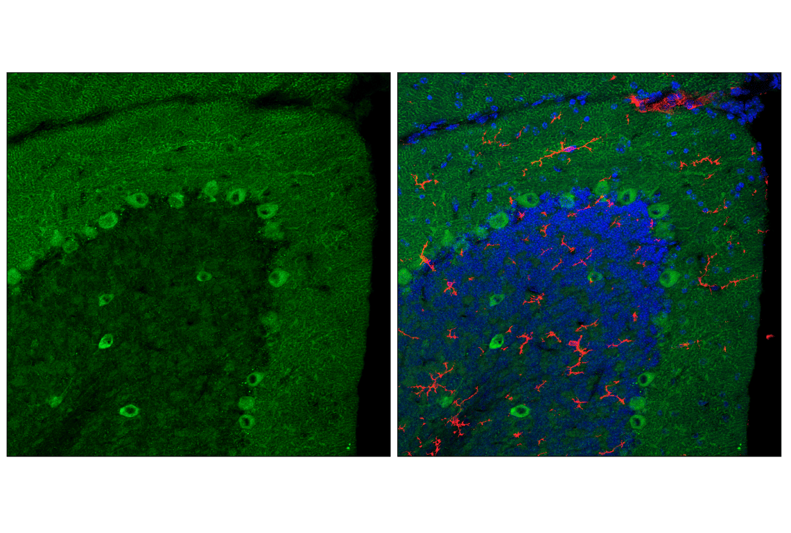 Immunofluorescence Image 2: VAPB (E7R3Z) Rabbit mAb