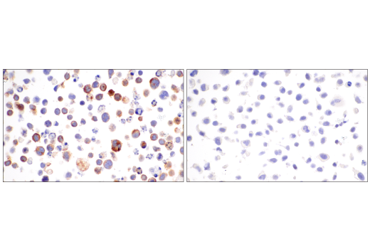 Immunohistochemistry Image 9: CD62P/P-Selectin (E8Q1W) XP<sup>®</sup> Rabbit mAb (BSA and Azide Free)