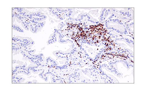 Immunohistochemistry Image 7: LAT (E3U6J) XP<sup>®</sup> Rabbit mAb (BSA and Azide Free)