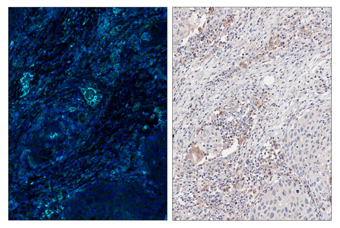 Immunohistochemistry Image 6: CD86 (E2G8P) & CO-0038-647 SignalStar<sup>™</sup> Oligo-Antibody Pair