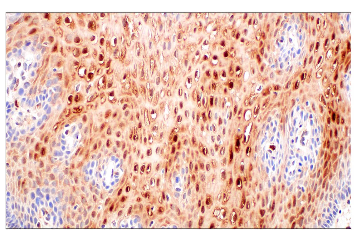 Immunohistochemistry Image 5: SerpinB1 (E4W7B) Rabbit mAb