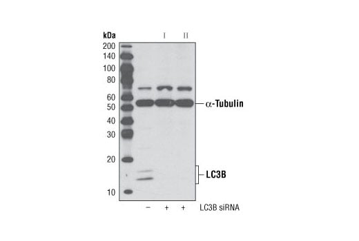 undefined Image 1: SignalSilence<sup>®</sup> LC3B siRNA II